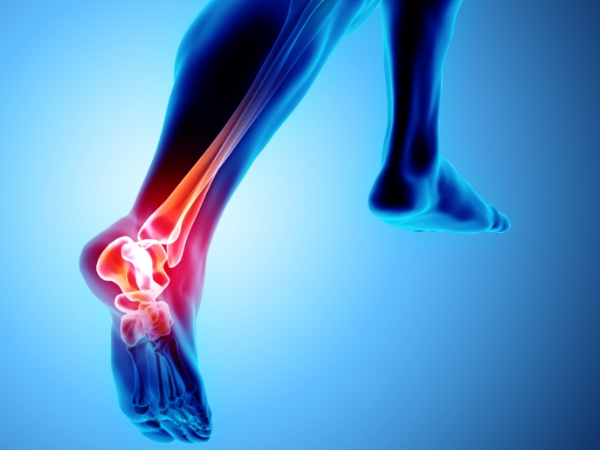 足首の痛み