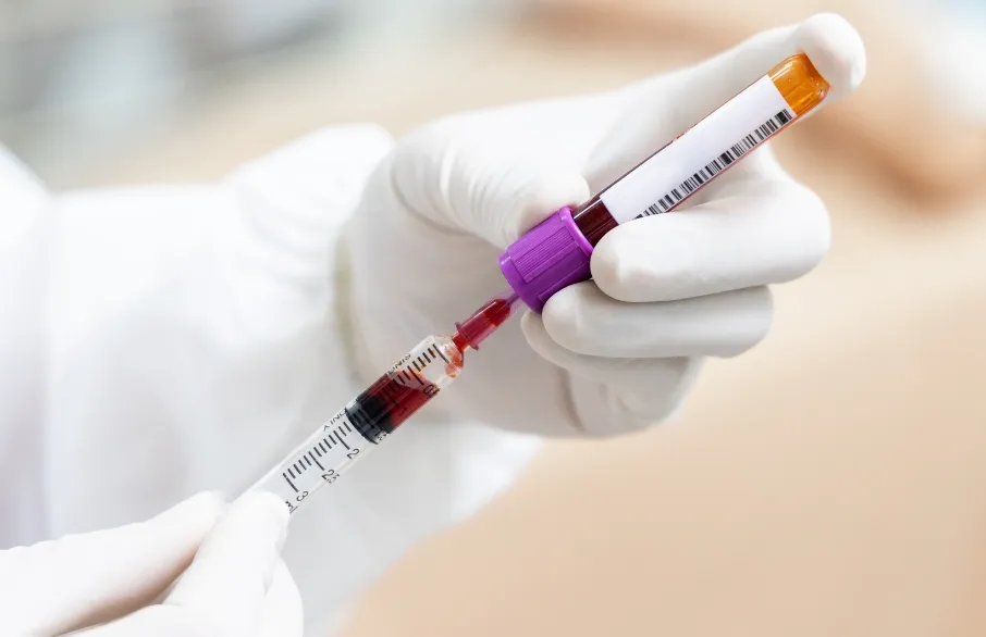 再生医療のPRP治療プレゼント！